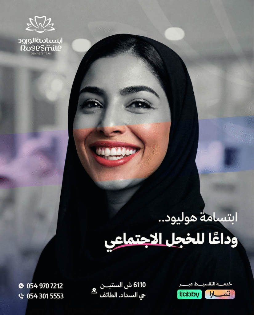 ابتسامة هوليود - Hollywood smile